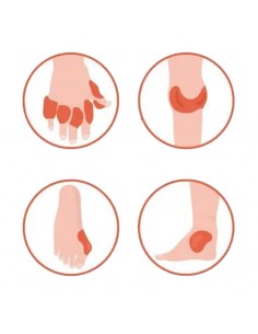 Пластири при подагра – Облекчаване на болка и възпаление, 8 броя 2 - Пластири за детоксикация
