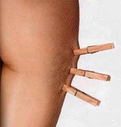 Билки премахват целулита