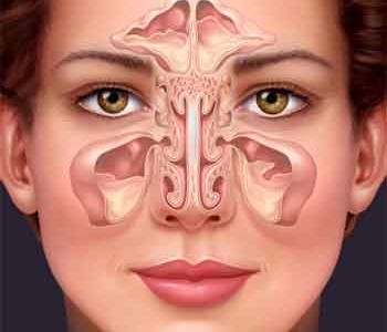 Антибиотиците не помагат при синузит