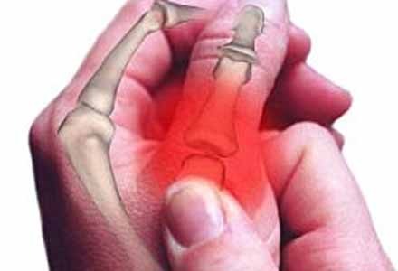 Продукти, които помагат при артрит