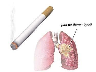 Соята помага при рак на белите дробове