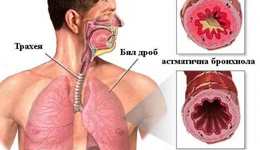 Джинджифилът облекчава астмата