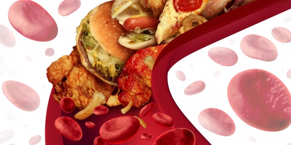 Висок (лош) холестерол - причини и симптоми