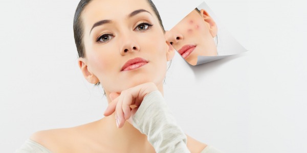 Защо цинкът е супер ефективен срещу акне