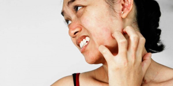 Основни методи при лечението на псориазис