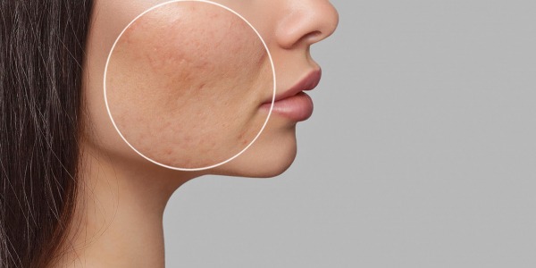 10 начина да свиете порите си