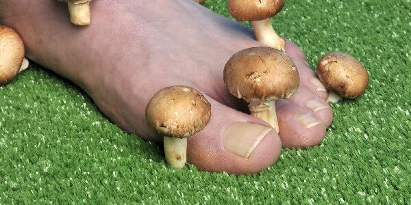 Основни видове микози