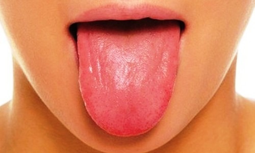Езикът-отражение на здравословното състояние