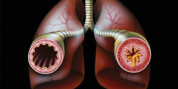 Вълшебната напитка, която намалява симптомите на астма!