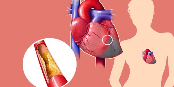 100% контрол върху холестерола с ябълков пектин!