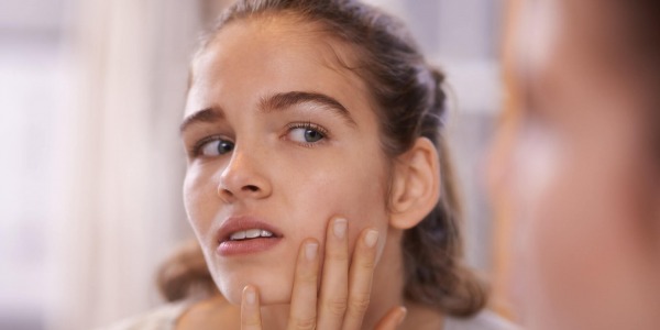 Мазна кожа и акне? Вижте какво съветват специалистите!