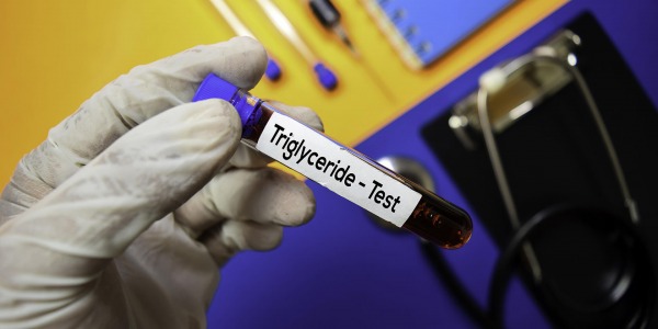Как да намалим триглицеридите?