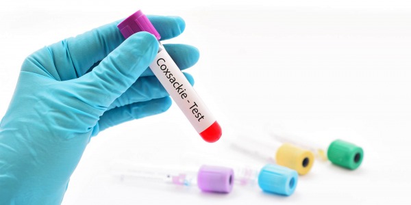 С какво се лекува коксаки вирус