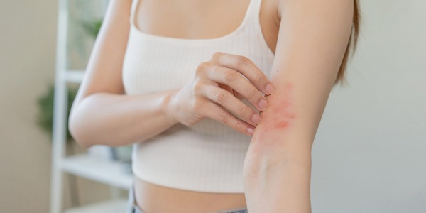 Червени петна по кожата – какво трябва да знаем?