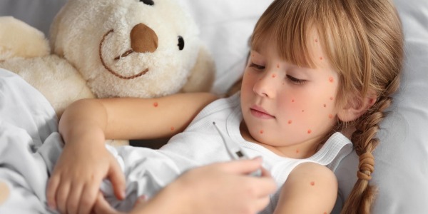 Какво се прави при Баба Шарка?