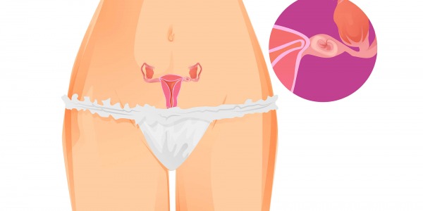 Какво представлява извънматочната бременност?