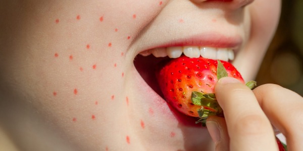 Пълно ръководство за алергични реакции и странични ефекти от билкови добавки при деца