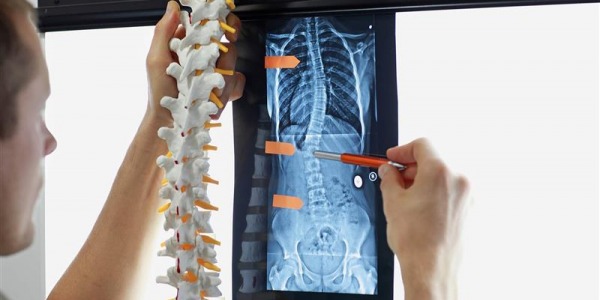 Сколиоза: симптоми и причини