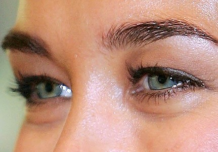 “Сбогом” на тъмните кръгове под очите